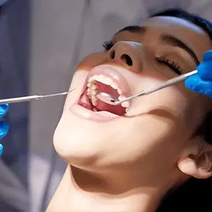 Dental Cleaning & Consultation at Dr. Lamya Clinic